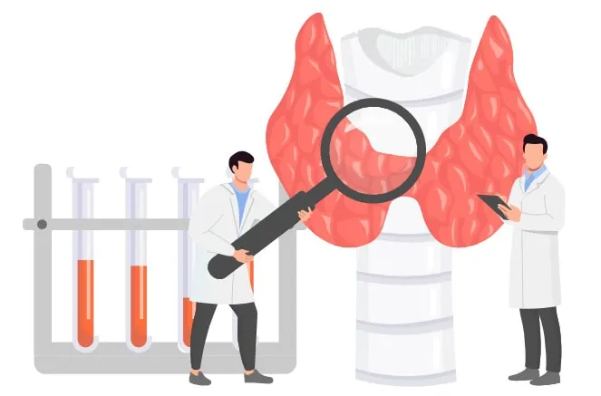 آزمایش تیروئید در منزل