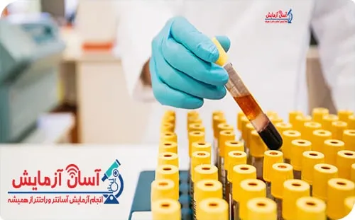 آزمایش چکاپ کامل در منزل