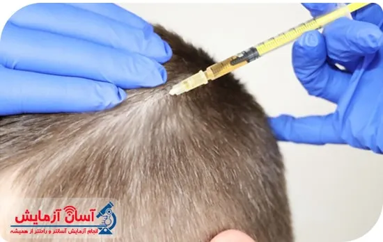 مزوتراپی مو چیست