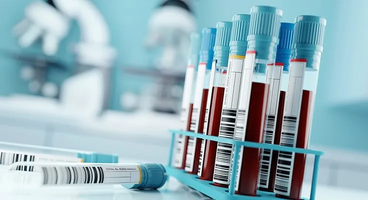 کجا آزمایش خون بدهیم